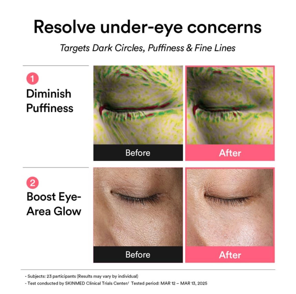 Abib - PDRN Retinal Eye Patch Glow Jelly patch