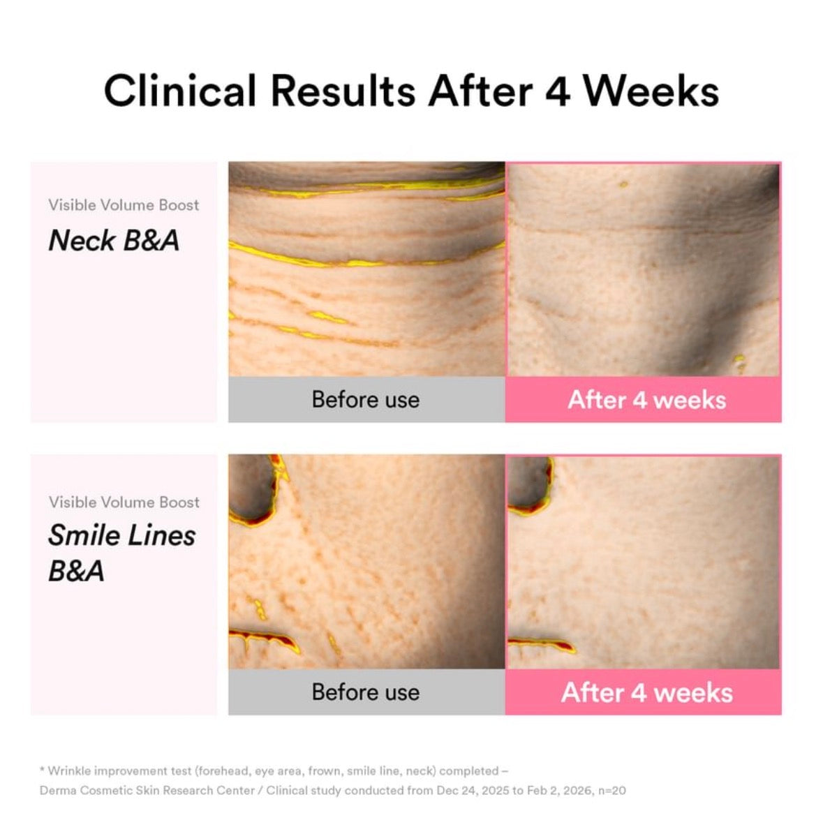 Abib - PDRN Volume Fill-it Booster Crème 2.5 Tube 30ml
